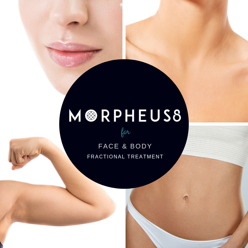 Morpheus8 Face, neck, arm, and abdomen