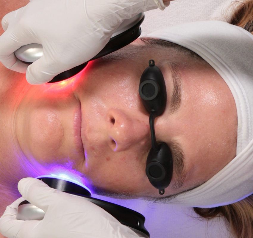 HydraFacial Red light therapy and blue light therapy