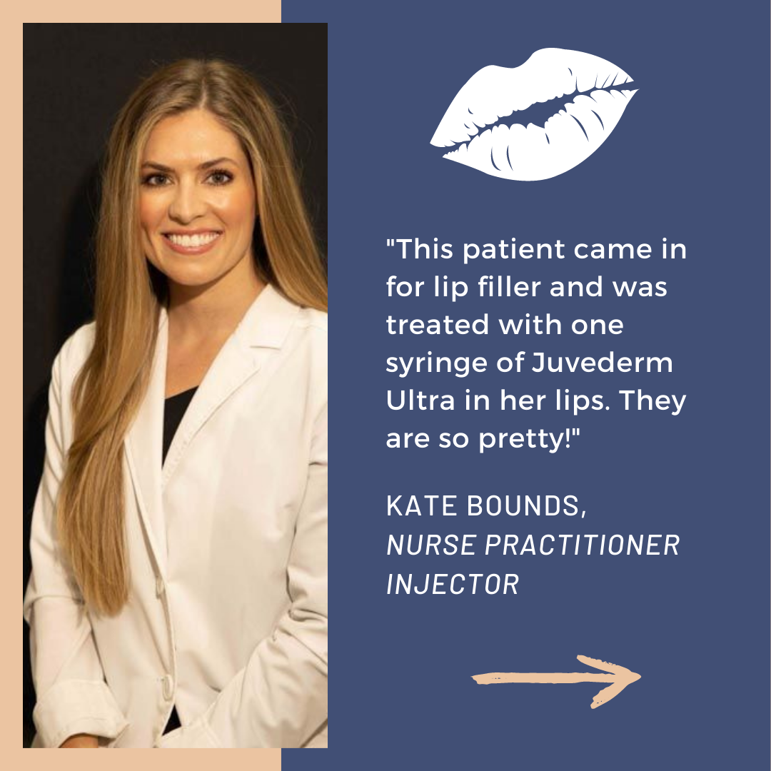 Juvéderm® in Knoxville, Tennessee