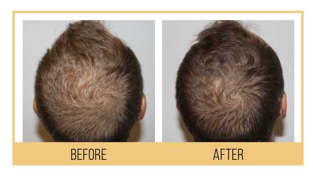 Screen Shot 2022-06-06 at 4.21.47 PM Hydrafacial Keravive