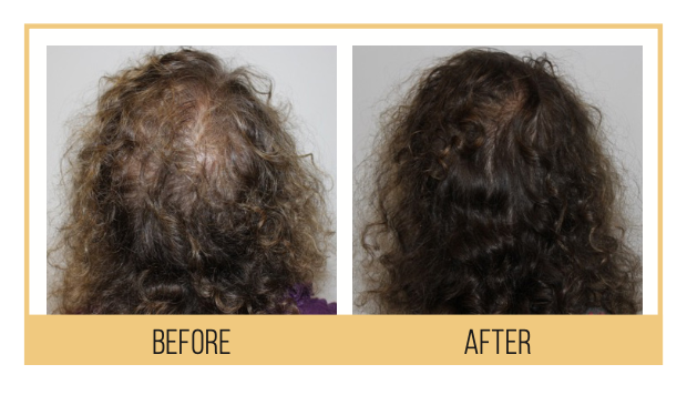 Screen Shot 2022-06-06 at 4.21.59 PM Hydrafacial Keravive