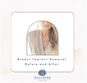 Gallaher Plastic Surgery - Current Specials & Events