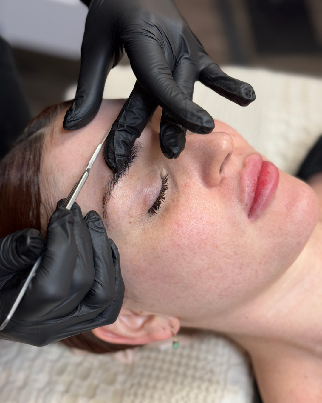 Dermaplane (2)